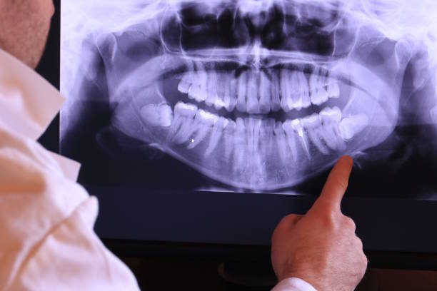 Best Emergency Treatment for Dental Infections or Abscesses in Pukalani, HI